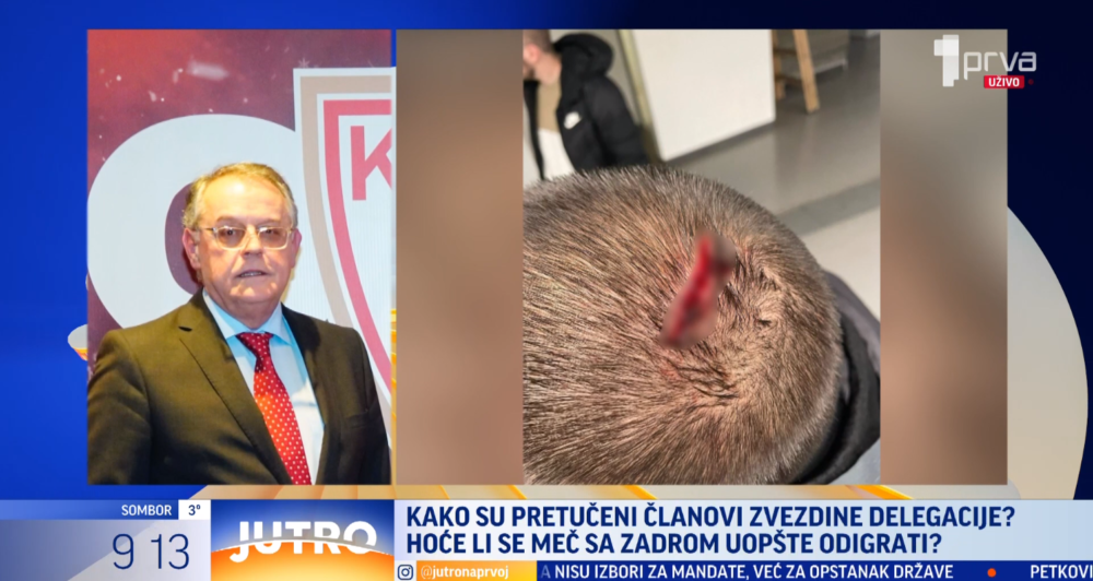 Čović za TV Prva: “Zvezda nikad nije bežala, igraćemo bez vređanja, a ko će izgubiti za zelenim stolom…”